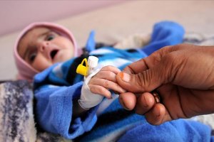 UNICEF: Yemen'de 12 milyon çocuk acil yardıma muhtaç