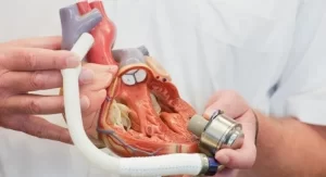 Dünya genelinde ilk kez Almanya’nın Hannover kentindeki klinikte “Heartmate III”