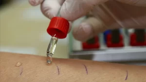 Çocuk Alerji ve İmmünoloji Uzmanı Doç. Dr. Mahir İğde, "Elbette