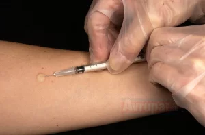 Almanya'da kızamık aşısı yaptırmak zorunlu oluyor. Ülkede 2020 yılından itibaren