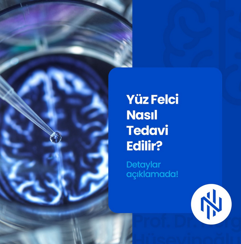 Baş ağrısında yeni dönem: Prof. Dr. Nergiz Hüseynoğlu botoks tedavisini anlattı 6 prof dr nergiz huseyinoglu 14
